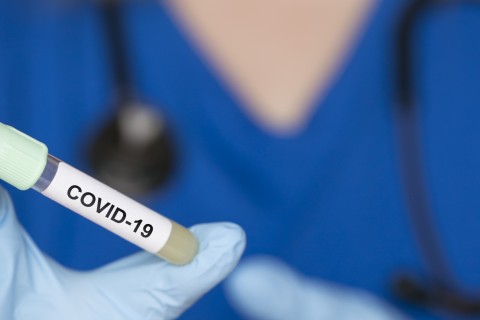 Test rapid anticorpi COVID-19 / SARS-CoV-2